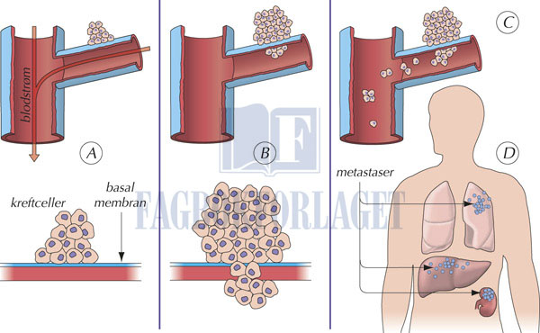 fig13-2.jpg