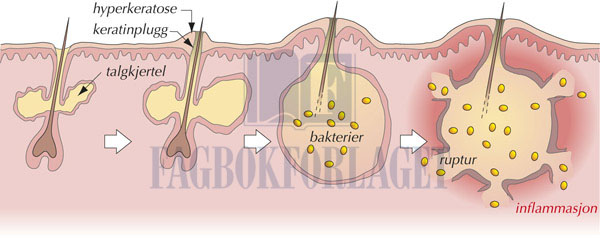 fig14-3.jpg